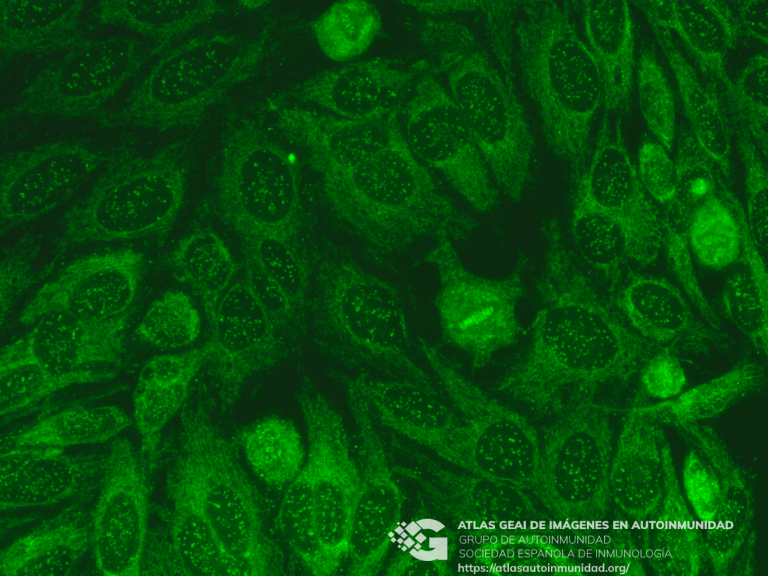 Centrómero / Citoplasmático reticular (AMA) Atlas GEAI de Imágenes en